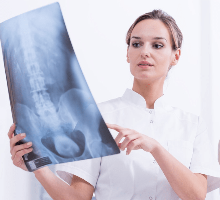 Diagnoza e osteokondrozës torakale me anë të ekzaminimit me rreze X
