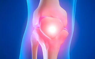 shkaqet e artrozës së kyçit të gjurit